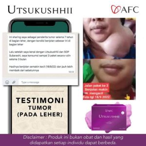 TUMOR-DI-LEHER-300x300 (1)